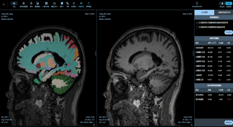 QuickMind MRI Processing Software (TIHip)