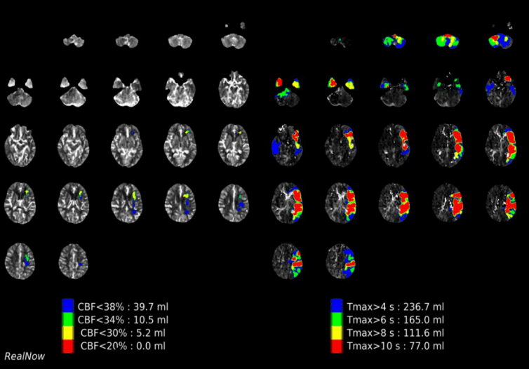 RealNow Medical Image Processing Software